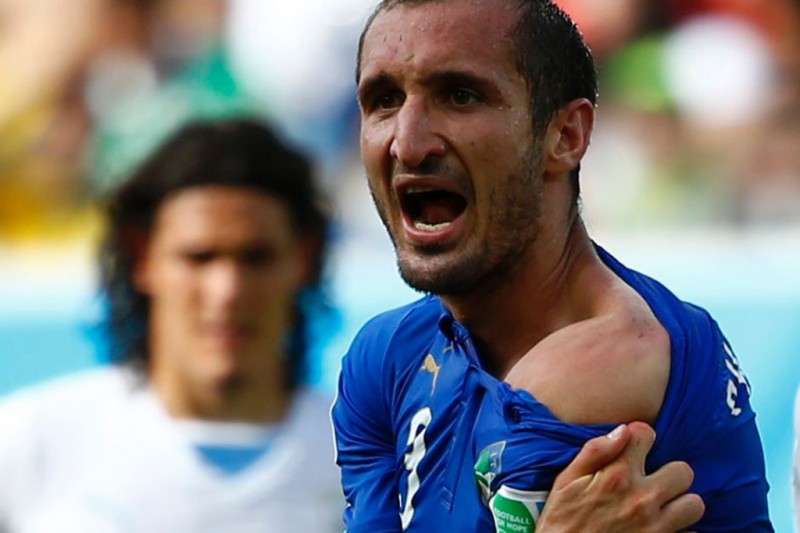 Giorgio Chiellini showing Suarez's bite marks, in Italy vs Uruguay
