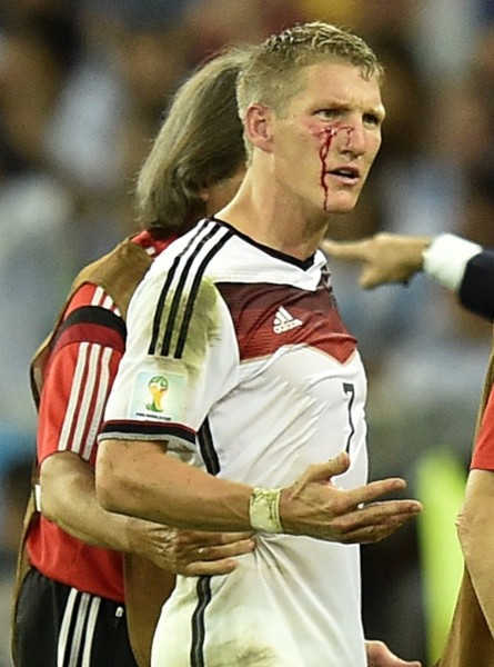 Bastian Schweinsteiger bleeding from his face in the World Cup final of 2014